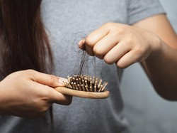 Video: Usulan Presiden Korsel Agar Perawatan Rambut Ditanggung Asuransi