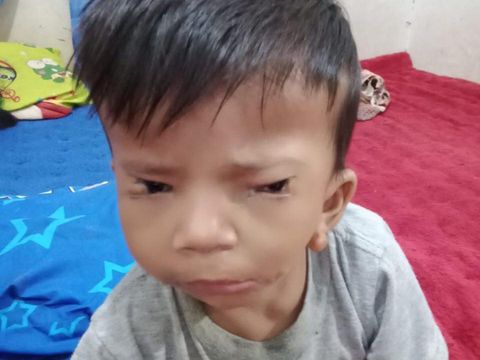 Abdul, ayah dari Abimana Rizki Afriliam, bersyukur anaknya sudah mulai berjalan. Meskipun demikian, proses berjalan Afriliam tidak seperti anak pada umumnya.