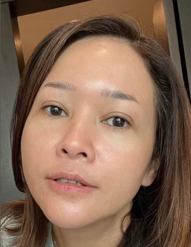 Maia Estianty mengungkap bahwa rosacea terjadi akibat terlalu sering memakai produk eksfoliasi kulit di usia 28 tahun. Foto: Instagram/@maiaestiantyreal