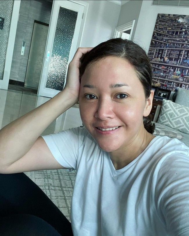 Maia Estianty juga berbagi cara merawat kulit rosacea. Dia mengingatkan agar tidak memakai produk pengelupasan kulit seperti AHA/BHA dan retinol yang persentase kandungannya tinggi.  Foto: Instagram/@maiaestiantyreal