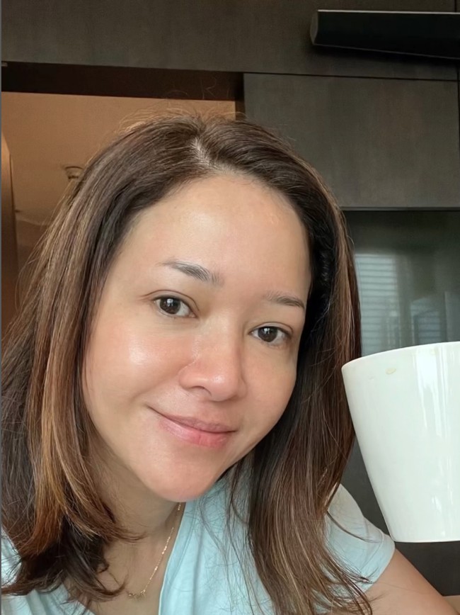 Rosacea adalah kondisi medis yang menyebabkan kulit kemerahan, gatal-gatal, bruntusan dan mudah berjerawat. Kondisi tersebut dialaminya sejak usia 36 tahun. Foto: Instagram/@maiaestiantyreal