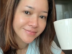 7 Wajah Maia Estianty Tanpa Makeup Setelah Perawatan Laser untuk Atasi Rosacea