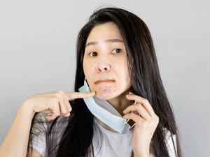 Jerawat di Dagu Artinya, Ada Gangguan Usus