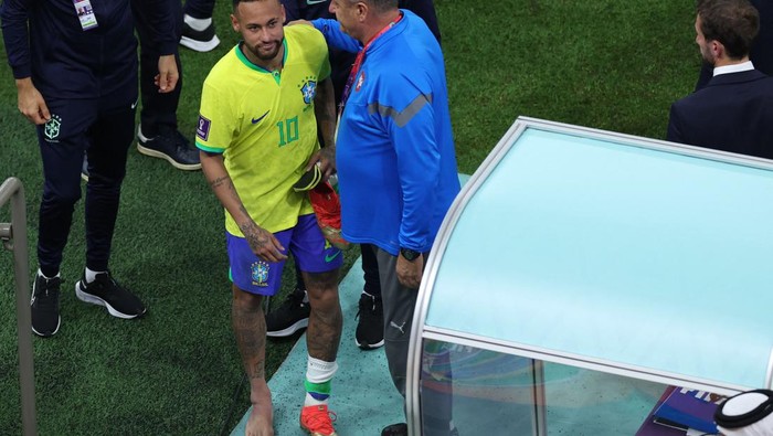 TOPSHOT - Picture of the swollen ankle of Brazils forward #10 Neymar taken as he leaves the field at the end of the Qatar 2022 World Cup Group G football match between Brazil and Serbia at the Lusail Stadium in Lusail, north of Doha on November 24, 2022. (Photo by Giuseppe CACACE / AFP) (Photo by GIUSEPPE CACACE/AFP via Getty Images)