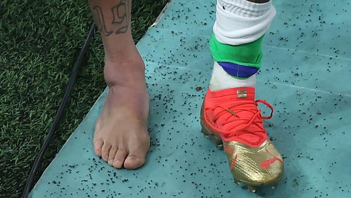 TOPSHOT - Picture of the swollen ankle of Brazils forward #10 Neymar taken as he leaves the field at the end of the Qatar 2022 World Cup Group G football match between Brazil and Serbia at the Lusail Stadium in Lusail, north of Doha on November 24, 2022. (Photo by Giuseppe CACACE / AFP) (Photo by GIUSEPPE CACACE/AFP via Getty Images)