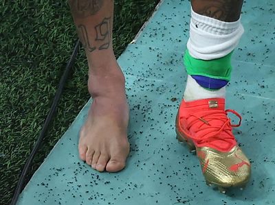 Engkel Neymar Bengkak Parah Usai Kena Tekel Pemain Serbia