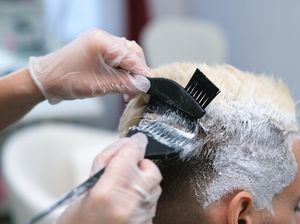 Masih Muda, Rambut Putih Semua? Belum Tentu Banyak Mikir, Ini Kemungkinannya