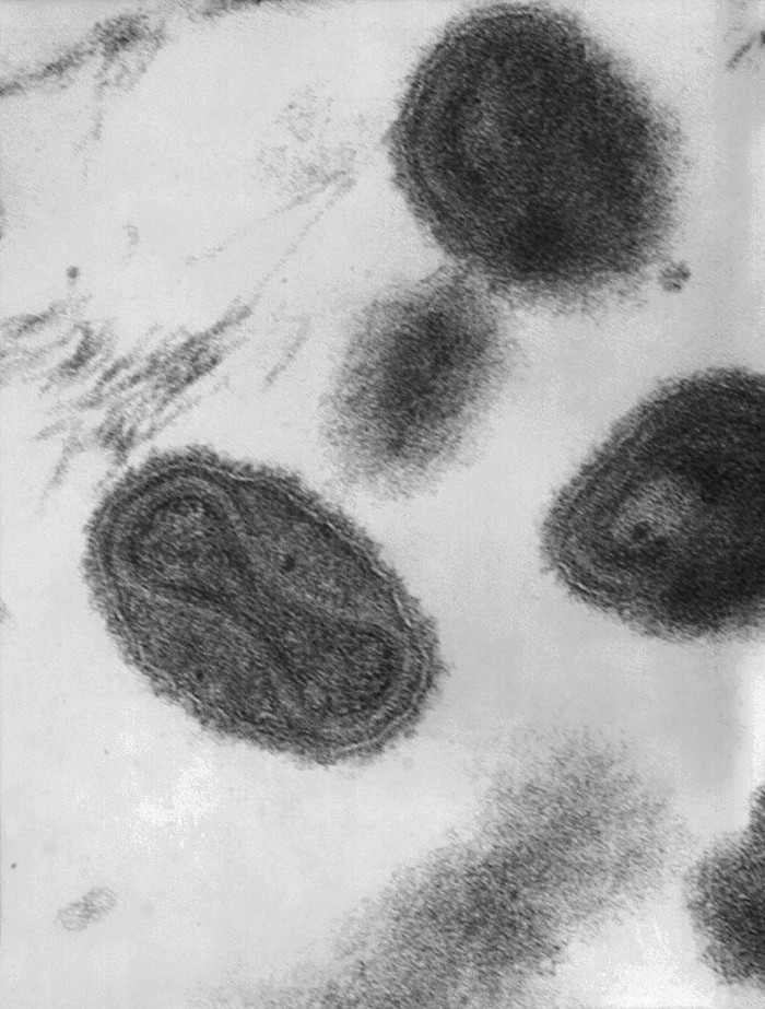 Virus tertua di dunia