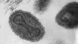 Ilmuwan Hidupkan Kembali Virus Zombi Berusia Hampir 50 Ribu Tahun, Apa Risikonya?