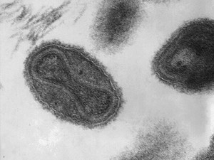 Ilmuwan Hidupkan Kembali Virus Zombi Berusia Hampir 50 Ribu Tahun, Apa Risikonya?