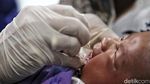Vaksinasi Polio Kembali Dikebut usai Indonesia Tetapkan KLB