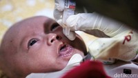 Perlu diketahui polio atau poliomyelitis adalah penyakit menular yang disebabkan oleh infeksi virus Polio. Penyakit ini menyerang fungsi sistem saraf sehingga pengidapnya akan mengalami kelumpuhan dalam hitungan jam atau bahkan kematian. Virus polio adalah penyebab utama dari penyakit paralisis ini. Ia berevolusi di usus, kemudian dikeluarkan melalui feses orang yang terinfeksi.