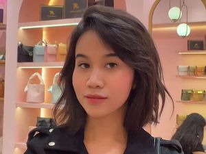 Mayang Pernah Filler hingga Taman Benang, Kini Habiskan Rp 50 Juta Oplas Hidung