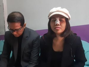 Mayang Viral Usai Oplas Hidung, Doddy Sudrajat Takut dan Bingung