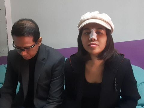 Mayang adik Vanessa Angel usai menjalani operasi hidung.