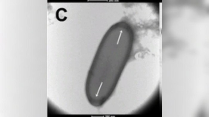 Fakta-fakta Virus Zombie Bangkit dari Lelehan Es, Bisa Picu Bencana Besar