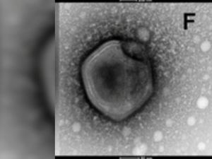 Ada Virus Zombie yang Dihidupkan Kembali Setelah 50.000 Tahun, Apakah Berbahaya?