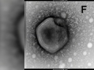 Ada Virus Zombie yang Dihidupkan Kembali Setelah 50.000 Tahun, Apakah Berbahaya?