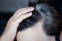 Berapa Jumlah Uban di Rambut Rasulullah SAW? Ini Penjelasan Ulama