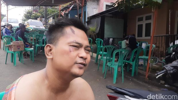 Korban selamat rombongan bus Semarang yang terjun ke Sarangan, Triyoga Surya Aditya (29). Foto diambil Senin (5/12/2022).