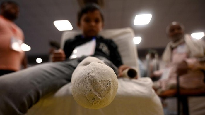 Melihat Produksi Kaki dan Tangan Palsu di India Hari Penyandang Cacat Internasional diperingati setiap 3 Desember. Peringatan ini bertujuan untuk memperjuangkan hak dan kesejahteraan para penyandang disabilitas.