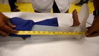 Seorang petugas mengukur kaki anak kecil untuk dibuatkan kaki palsu.