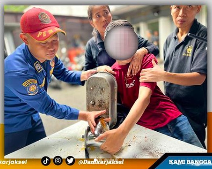 Tangan warga masuk ke mesin giling, petugas Damkar Jaksel menyelamatkan. (Dok Sudin Damkar Jaksel)