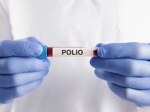 Video: Kabar Baik! KLB Polio di Indonesia Dinyatakan Berakhir