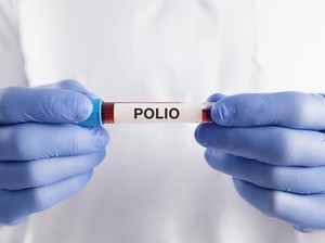 24 Oktober 2025 Hari Polio Sedunia, Tujuan dan Cara Merayakan
