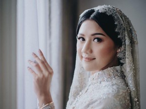Potret Anggunnya Erina Calon Istri Kaesang Jelang Momen Pernikahan