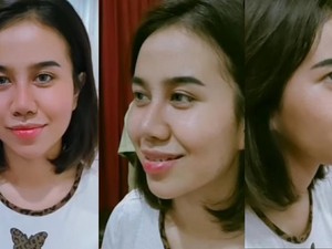 Tampilan Wajah Baru Mayang usai Operasi Hidung, Bikin Pangling?