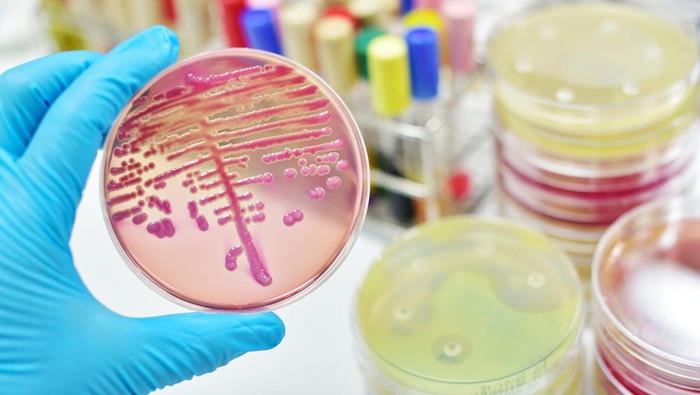 Bakteri E. Coli