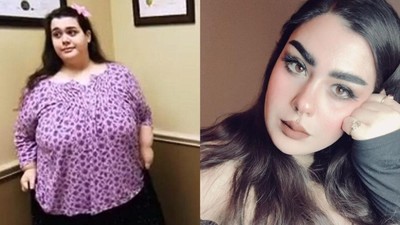 Potret Transformasi Wanita yang Dulunya Berbobot 317 Kg, Kini Bikin Pangling!