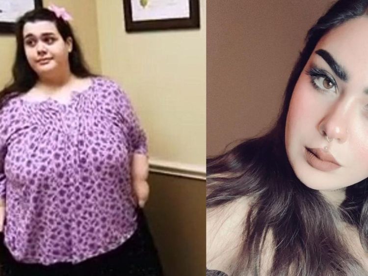 Potret Transformasi Wanita yang Dulunya Berbobot 317 Kg, Kini Bikin Pangling!