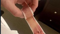 Sekilas terlihat seperti plester, ternyata ini adalah gulungan bacon milik seorang netizen kreatif. Menurutnya bacon sama dengan P3K yang menjadi pertolongan pertama pada saat kelaparan. Foto: Bored Panda