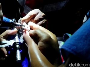 Tangis Bocah Bandung Saat Jarinya Terjebak di Slot Kunci