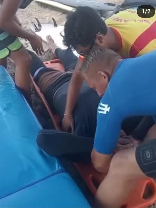 Turis Rusia kecelakaan saat surfing di Pantai Kuta ditolong balawista, Selasa (13/12/2022).