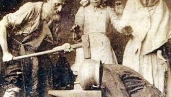 Vibration Therapy, Pengobatan Sakit Kepala Di Tahun 1890-an Foto: Boredpanda