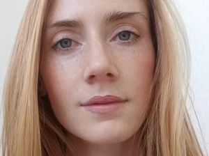 Mahasiswi Australia Meninggal Usai Jalani Perawatan Gigi di Bali