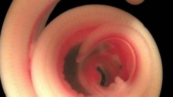 Bayi ular. Foto: Imgur