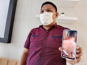 Polisi Usut Kasus Siswa SD di Manado Diduga Dianiaya Gurunya