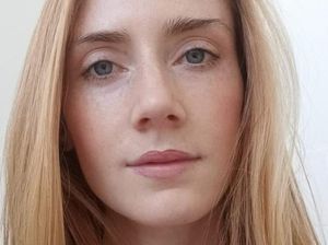 Fakta Terkini Mahasiswi Aussie Meninggal Usai Perawatan Gigi di Bali