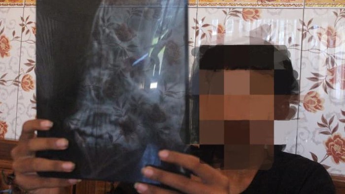 Korban pengeroyokan pesilat di Jombang menunjukan hasil rontgen kepalanya