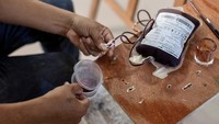Lahir di rumah tangga berpenghasilan rendah dengan sedikit akses ke perlengkapan sekolah dan bahan seni, Circa menjelajahi berbagai media, termasuk plum dan tomat. Tetapi dia tertarik menggunakan darahnya untuk melukis. Hal itu terjadi saat Circa tak sengaja terluka dan berdarah, dari sana lah idenya muncul untuk menjadi darah bagian dari karya seninya. Sekarang, Circa pergi ke klinik kesehatan kota setiap tiga bulan sekali untuk diambil darahnya.
