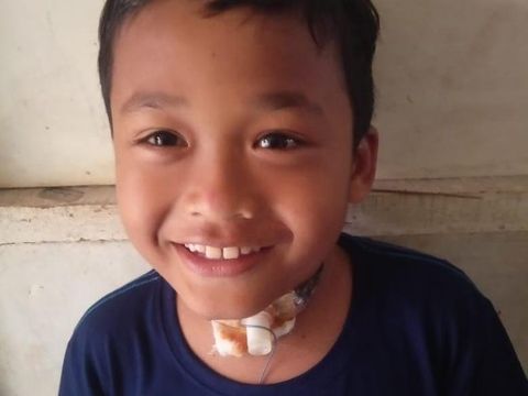 Kabar baik datang dari Rafli, bocah yang lehernya bolong karena ditendang sapi. Leher Rafli yang bolong akan segera dilakukan operasi penutupan.