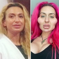 Tak hanya dipandang aneh, karena penampilannya ini Anastasia Pokreshchuk mengaku sering mendapat hujatan dari netizen. Tapi hal itu tidak menyurutkan niatnya untuk terus menginjeksi wajah dengan filler dan Botox. Foto: Instagram/@justqueen8888