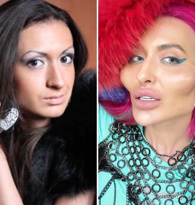 “Setelah disuntik dan melihat perubahan pada pipiku, aku jatuh cinta. Aku mengerti orang melihatnya aneh tapi aku tidak masalah, katanya seperti dikutip dari Daily Star. Foto: Instagram/@justqueen8888