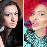 “Setelah disuntik dan melihat perubahan pada pipiku, aku jatuh cinta. Aku mengerti orang melihatnya aneh tapi aku tidak masalah, katanya seperti dikutip dari Daily Star. Foto: Instagram/@justqueen8888