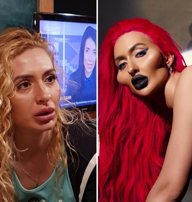 Anastasia pertama kali melakukan perawatan filler di usia 26. Ketika itu, ia filler untuk menebalkan bibir sekaligus Botox di bagian dahi. Hal lain yang dilakukannya adalah veneer gigi. Dia pun mengakui ia jatuh cinta dengan perubahan pada pipinya dan ingin membuatnya tampak besar dan menonjol. Foto: Instagram/@justqueen8888