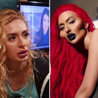 Anastasia pertama kali melakukan perawatan filler di usia 26. Ketika itu, ia filler untuk menebalkan bibir sekaligus Botox di bagian dahi. Hal lain yang dilakukannya adalah veneer gigi. Dia pun mengakui ia jatuh cinta dengan perubahan pada pipinya dan ingin membuatnya tampak besar dan menonjol. Foto: Instagram/@justqueen8888